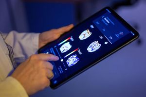 Gehirnbilder eines Patienten in einer KI-basierten App. Nach einer Deloitte-Umfrage sehen viele Bürgerinnen und Bürger den Einsatz von KI in der Medizin skeptisch, vor allem wenn es um die Therapie geht. (Symbolbild) - Foto: Monika Skolimowska/dpa
