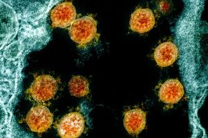 Partikel des Coronavirus SARS-CoV-2 wurden für eine elektronenmikroskopische Aufnahme farblich bearbeitet. - Foto: Uncredited/NIAID/NIH/dpa