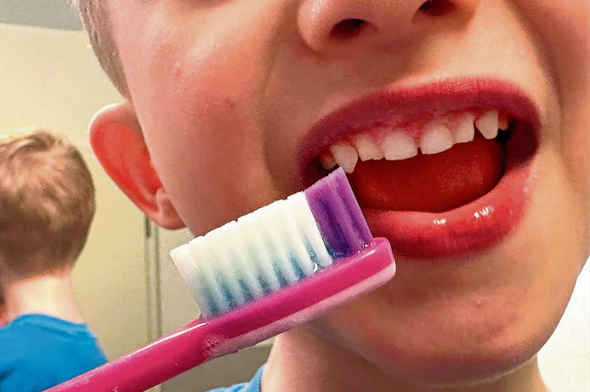 Im Kreisgesundheitsamt weiß man: Gesunde Kinderzähne sind häufig auch eine Frage des sozialen Status. Foto: Kalle (Kreis Soest)