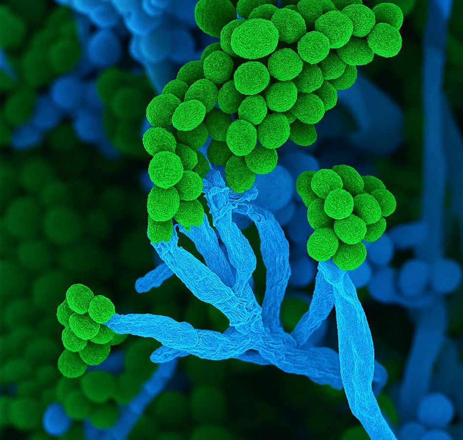 Penicillium bedeutet auf Lateinisch «kleiner Pinsel», weil die Zellketten mit Sporen am Ende so ähnlich aussehen (Handout) - Foto: Ulrich Kück/ Birgit Hoff/Vereinigung für Allgemeine und Angewandte Mikrobiologie/dpa