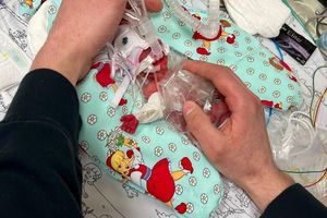 Etwas mehr als ein Päckchen Butter wog die kleine Marie, als sie im Februar zur Welt kam. Seitdem ist das Kind gut gewachsen. - Foto: Privat/Kinderklinik Dritter Orden Passau/dpa