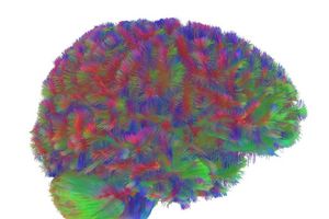 Sogenannte MRT-Diffusionsscans lassen deutliche Unterschiede der Hirnstruktur abhängig vom Alter erkennen. - Foto: Dr Alexa Mousley/University of Cambridge/dpa