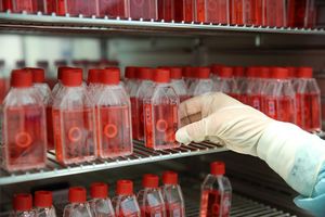 In einer Gewebebank zeigt eine Mitarbeiterin den Brutschrank mit präparierter menschlicher Hornhaut. - Foto: Bernd Wüstneck/dpa-Zentralbild/dpa