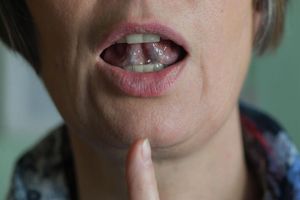 Stotternde Menschen können mit Hilfe von regelmäßigen Sprechübungen ihren Redefluss verbessern. (Symbolbild) - Foto: Jens Kalaene/zb/dpa