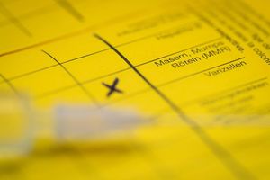 Bei Masern zeigt sich erst oft Fieber, bevor später ein Hautausschlag dazukommt. (Symbolbild) - Foto: Friso Gentsch/dpa