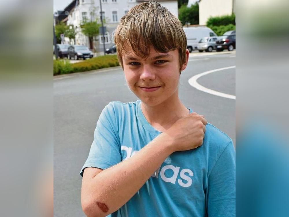 Am Kreisverkehr nahe des Bahnhofs ereignete sich der Unfall, bei dem sich Joshua Dickhage am Arm verletzte. Foto: Kossack