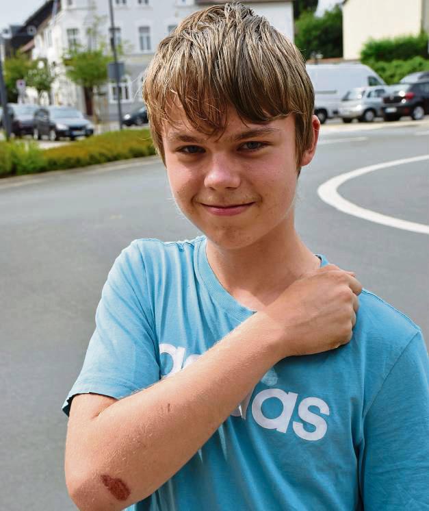 Am Kreisverkehr nahe des Bahnhofs ereignete sich der Unfall, bei dem sich Joshua Dickhage am Arm verletzte. Foto: Kossack
