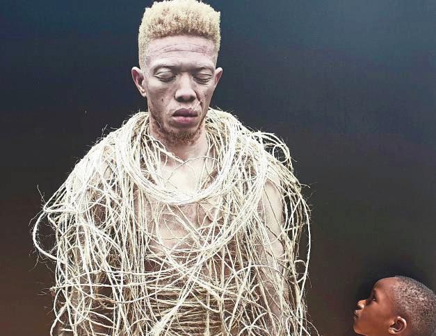 Gefangen im eigenen Körper: In Afrika haben es Albinos nicht leicht. Zuweilen werden sie verfolgt, entführt und auch getötet.