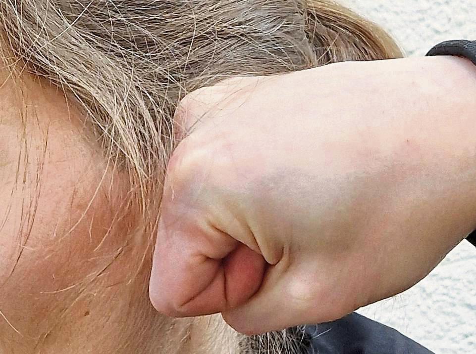Ein Faustschlag mit Folgen passierte in Altenrüthen im vergangenen Mai. Symbolfoto: Stallmeister