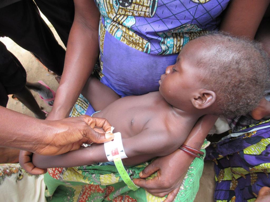 Die meisten Hungernden lebten im vergangenen Jahr in der Demokratischen Republik Kongo (25,8 Millionen), gefolgt von Nigeria, dem Sudan und Afghanistan. - Foto: Kate Bartlett/dpa