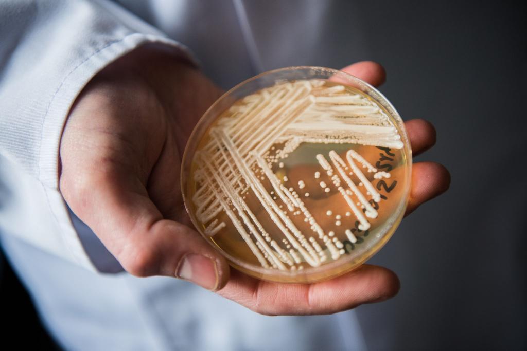 Eine Petrischale mit dem Hefepilz Candida auris. In Deutschland werden immer mehr Fälle des krankmachenden Pilzes bekannt. - Foto: Nicolas Armer/dpa