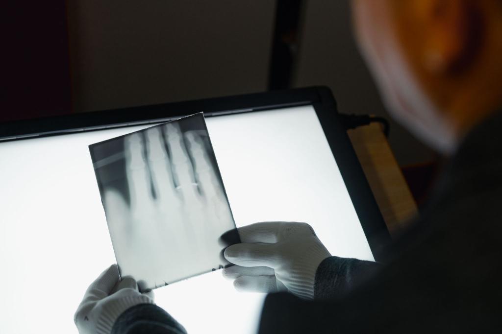 Ein Röntgenbild der Hand von Wilhelm Röntgen gehört nun zum Unesco-Weltdokumentenerbe. (Archivbild) - Foto: Marius Becker/dpa