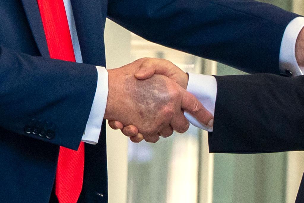Zu sehen beim Händedruck mit dem südkoreanischen Präsidenten Lee: ein Bluterguss auf Trumps rechter Hand. - Foto: Alex Brandon/AP/dpa