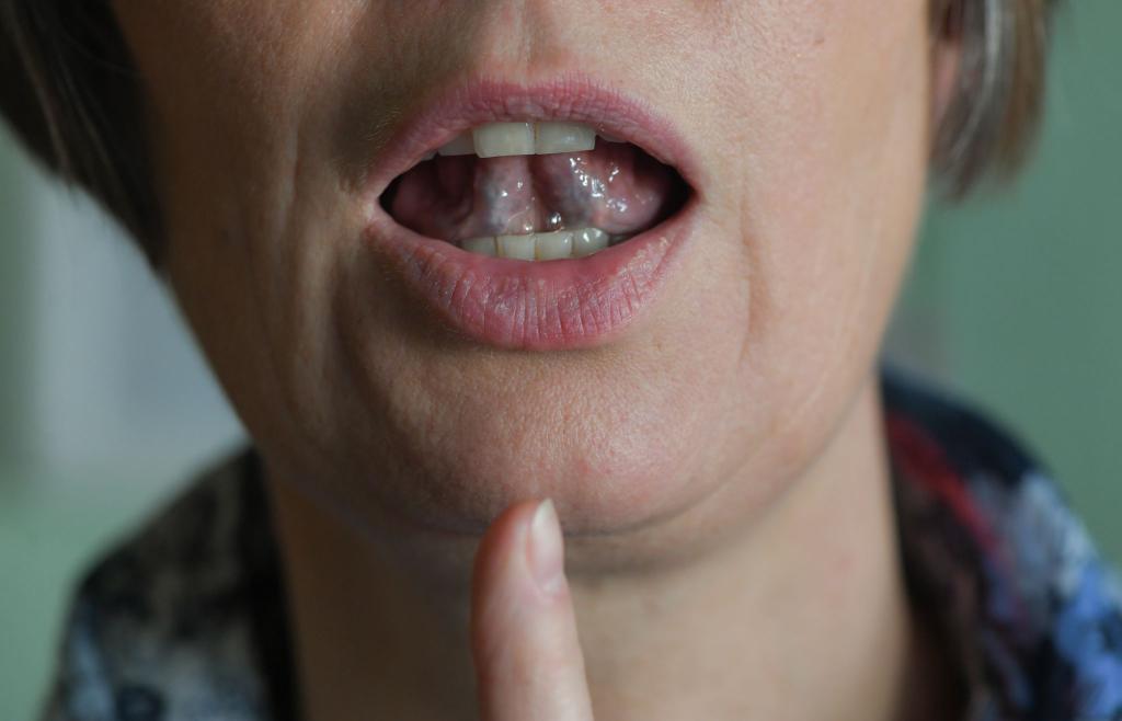 Stotternde Menschen können mit Hilfe von regelmäßigen Sprechübungen ihren Redefluss verbessern. (Symbolbild) - Foto: Jens Kalaene/zb/dpa