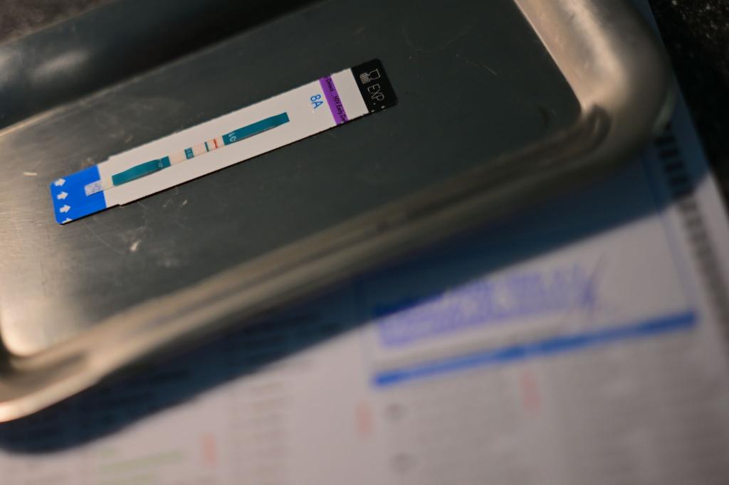 HIV-Diagnosen werden oft erst Jahre nach der Infektion gestellt. (Symbolbild) - Foto: Sebastian Gollnow/dpa